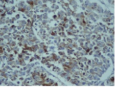 Fig 1C